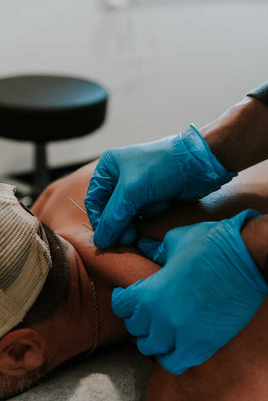 dry needling for shoulder pain dry needling for hip pain dry needling for ankle pain sun prairie chiropractor dry needling